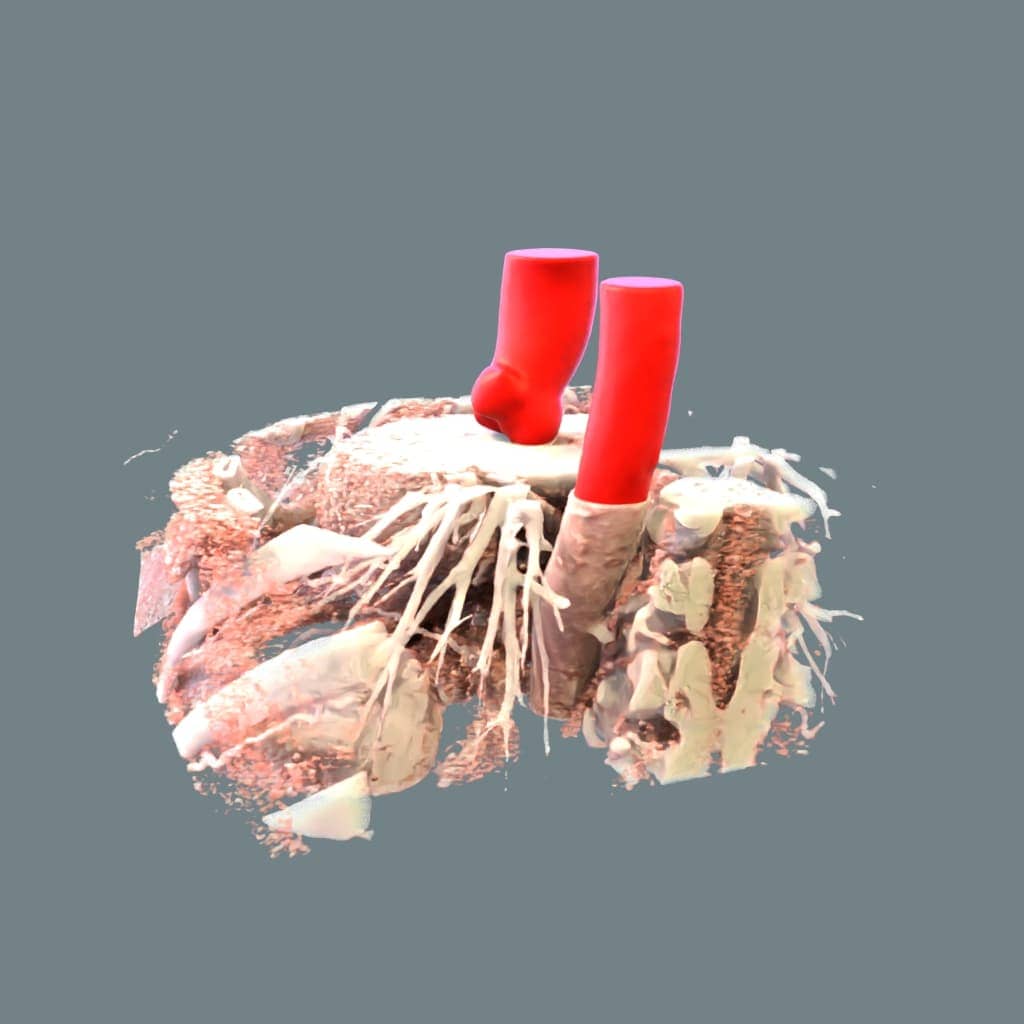 image of segmentation of the thoracic aorta