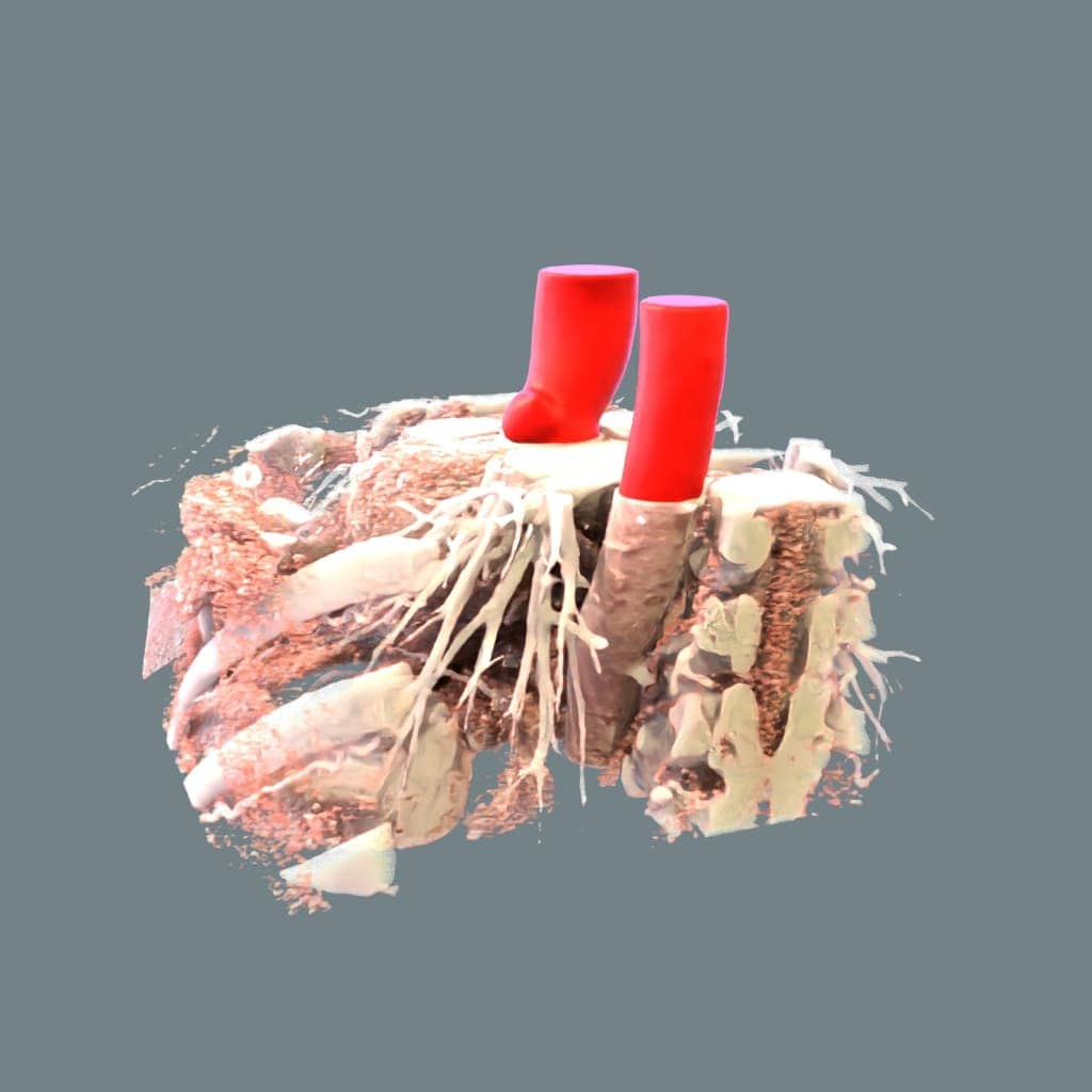 segmentation of thoracic aorta algorithm