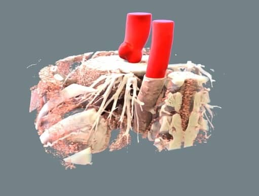 Segmentation of the thoracic aorta in contrast enhanced CT images