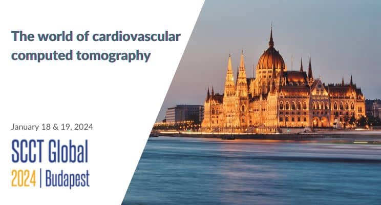 SCCT GLOBAL 2024 – our coronary artery calcification scoring algorithm