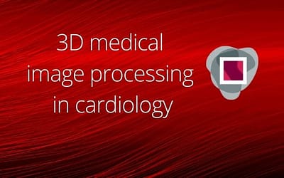 3D medical image processing in cardiology  