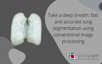 Take a deep breath: fast and accurate lung segmentation using conventional image processing