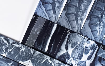 Exploring the reuse of clinical data for advanced AI pharma research purposes