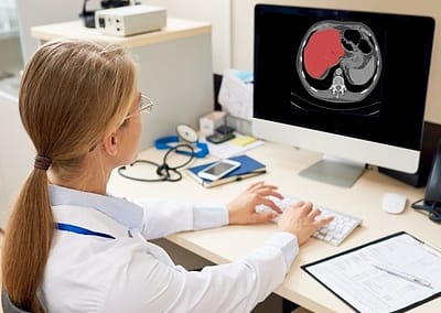 Cirrhosis detection from CT scans