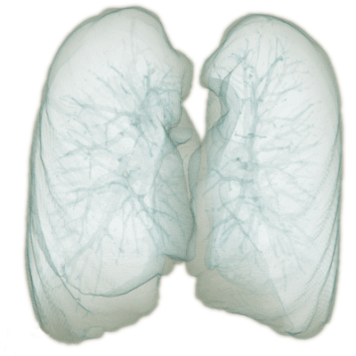 3D rendering of the lung segmentation produced with the algorithm