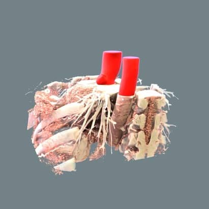 segmentation of thoracic aorta