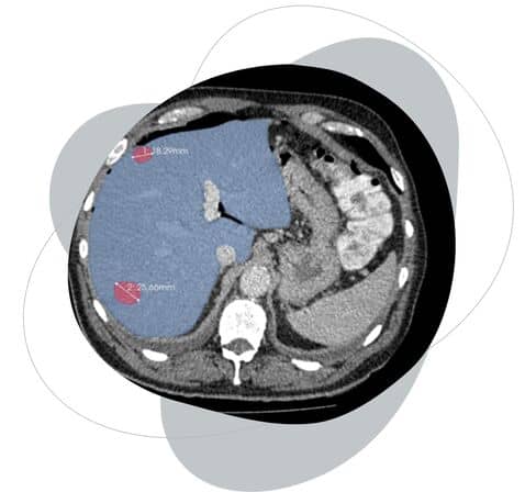 image-cover to case study about medical software development