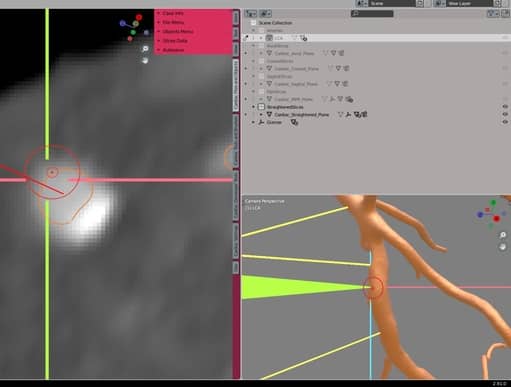 screen of a Blender plugin by Graylight Imaging for facilitation of the segmentation of coronary vessels