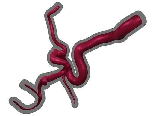 3d model of geometry of blood vessel