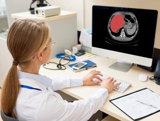 The picture freatured a woman doctor who is working on computer with cirrhosis detection from CT scans software.
