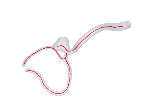 Calculated centerlines for the mesh of a brain aneurysm in 3d