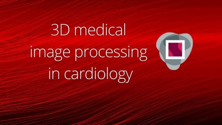 cover of graylight post 3d medical image processing in cardiology