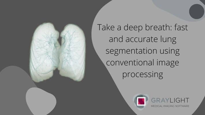 3d model from automated lung segmentation with vascular tree marked