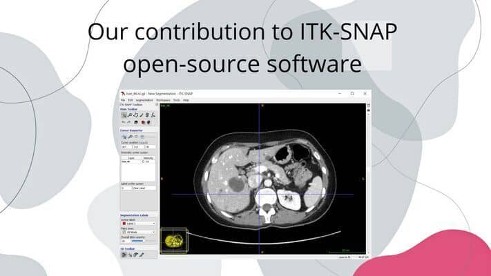 screen shot from ITK-SNAP an open source software to which graylight imaging created a plugin
