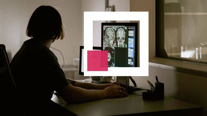 a female doctor works on Semi-automatic segmentation of a brain MRI