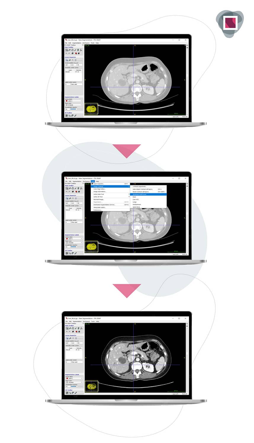 screen shot from ITK-SNAP an open source software to which graylight imaging created a plugin