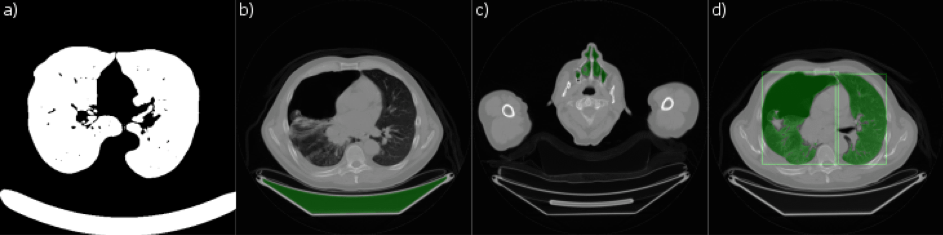 steps of the lung segmentation algorithm