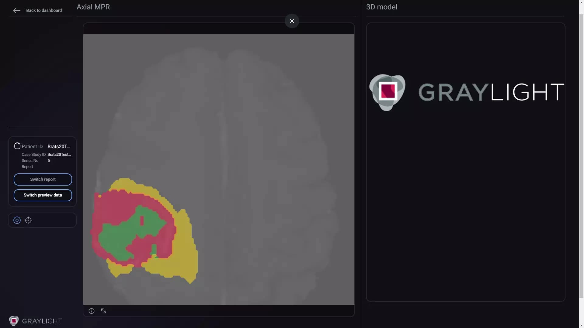 Medical data visualization tool Graylight Imaging