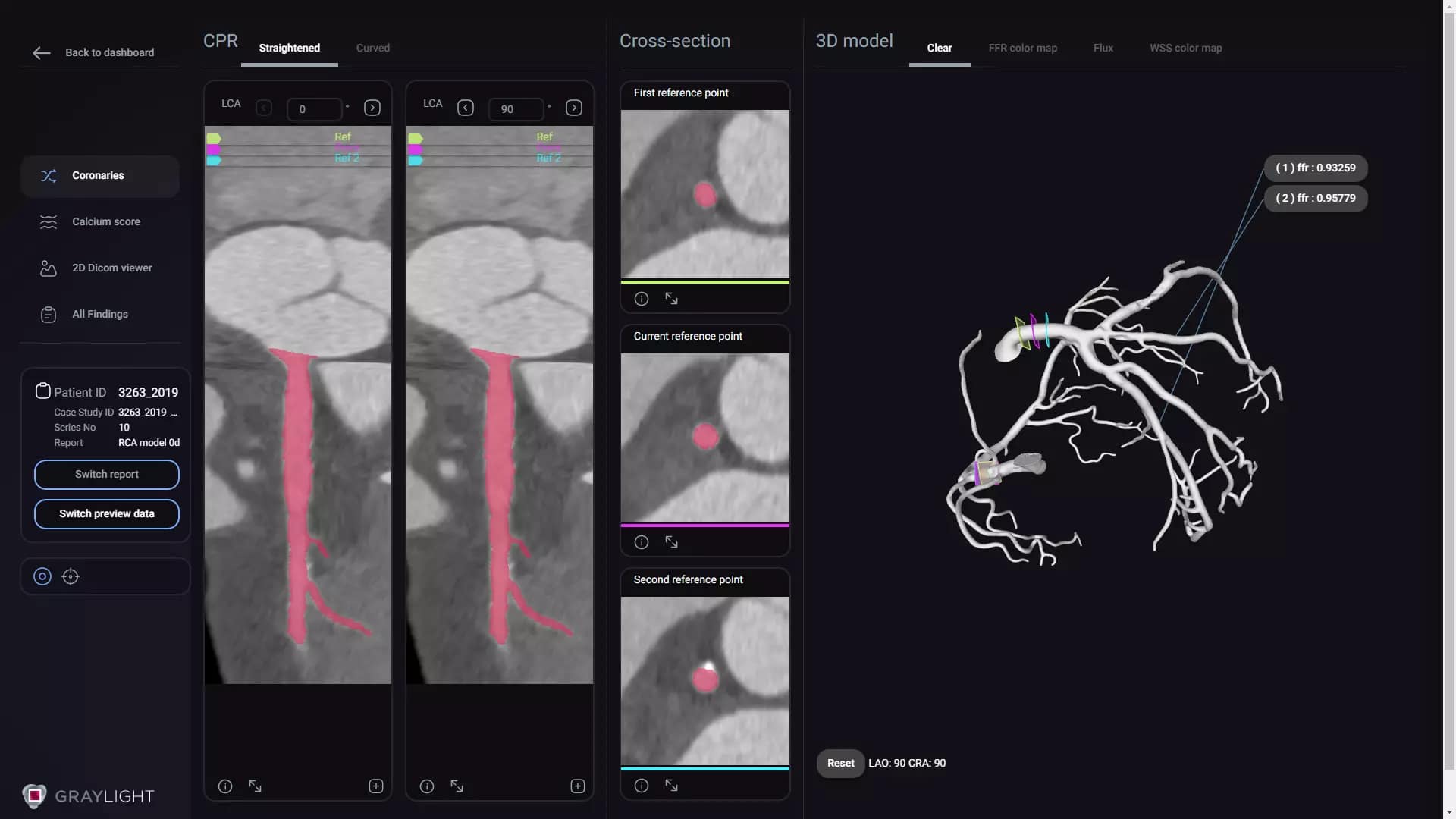 Medical data visualization tool Graylight Imaging