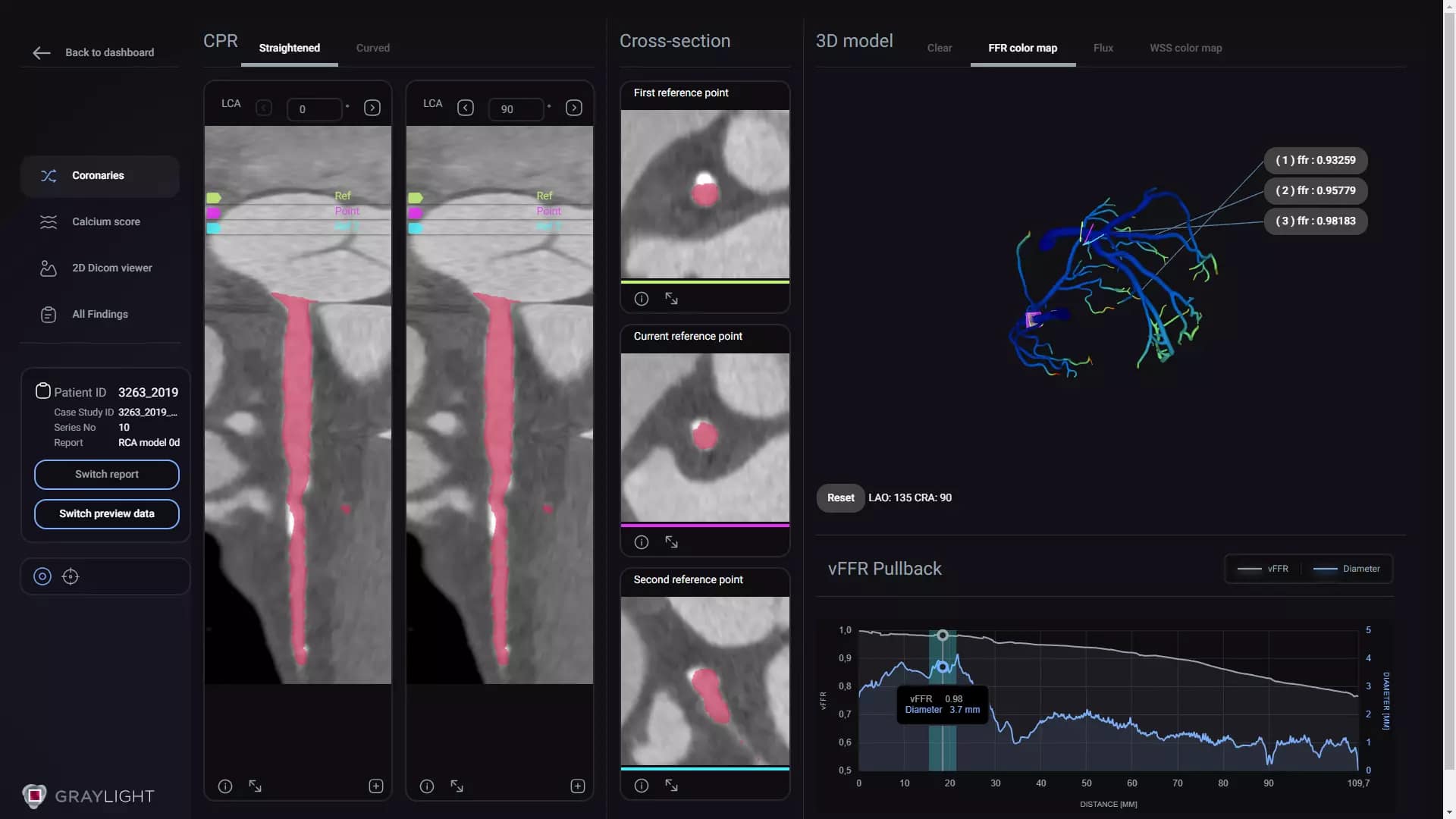 Medical data visualization tool Graylight Imaging